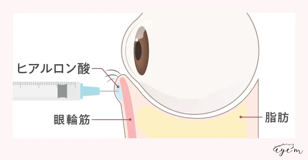 施術方法の解説