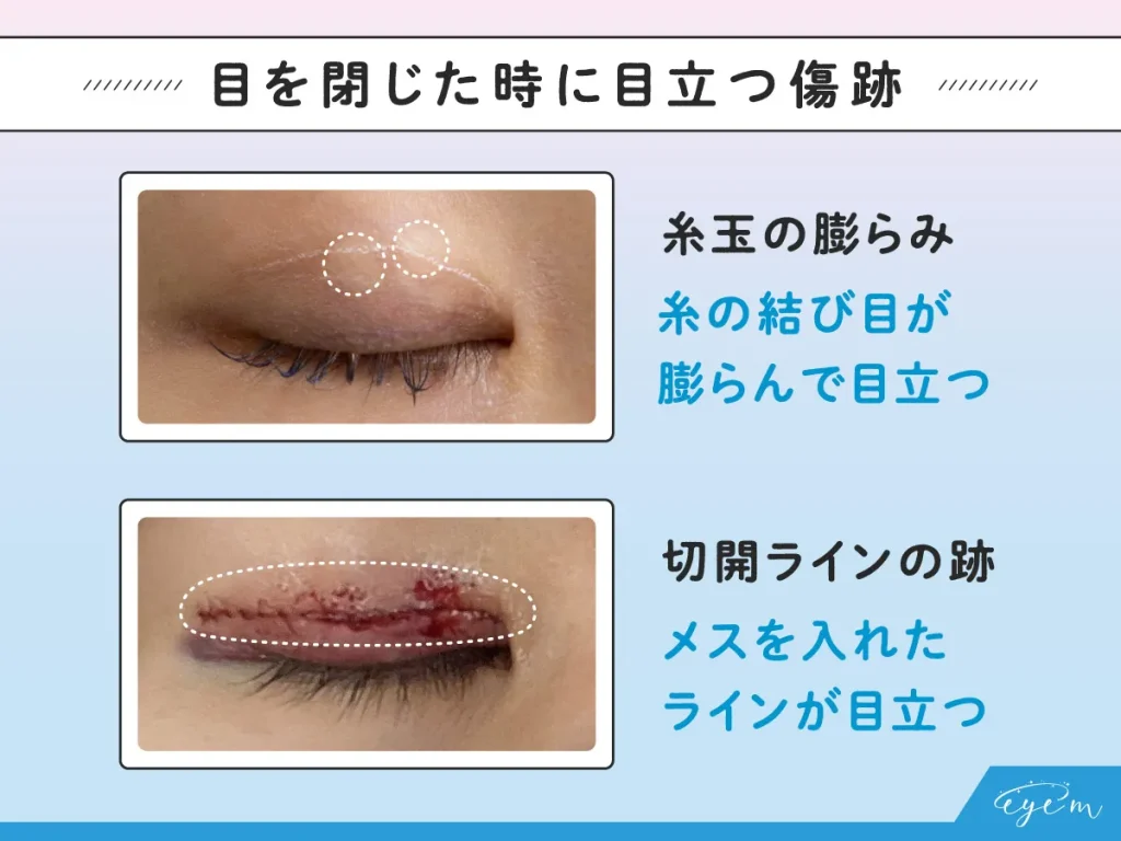 目を閉じた時に傷跡が目立つ目元