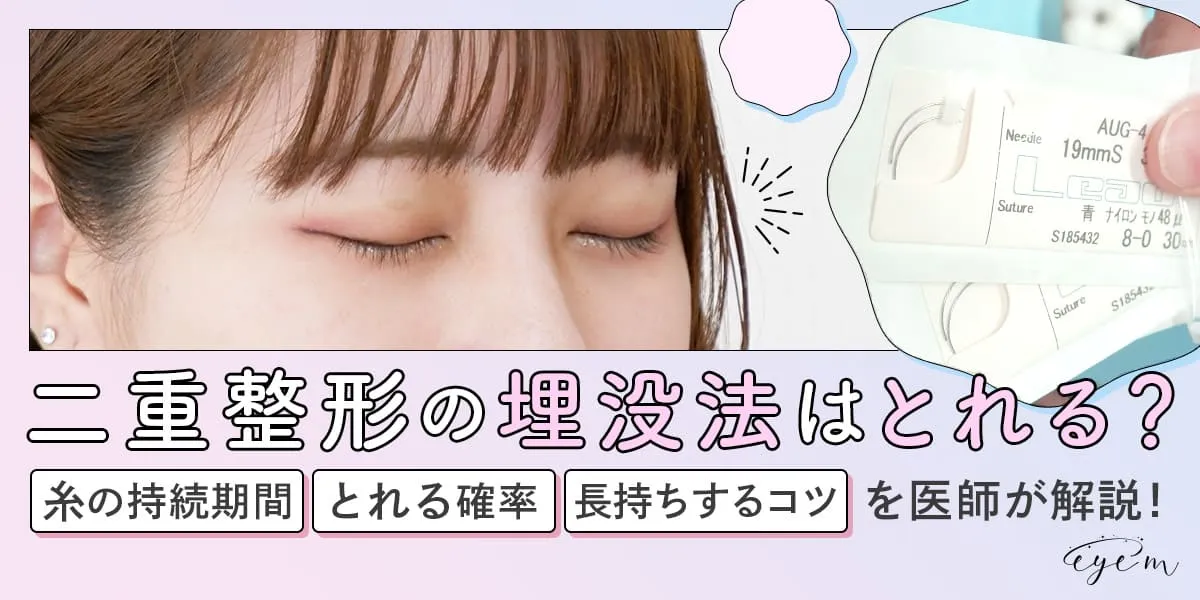 二重整形の埋没法はすぐとれる？原因や取れる確率、長持ち(癒着)しやすいコツを医師が解説！