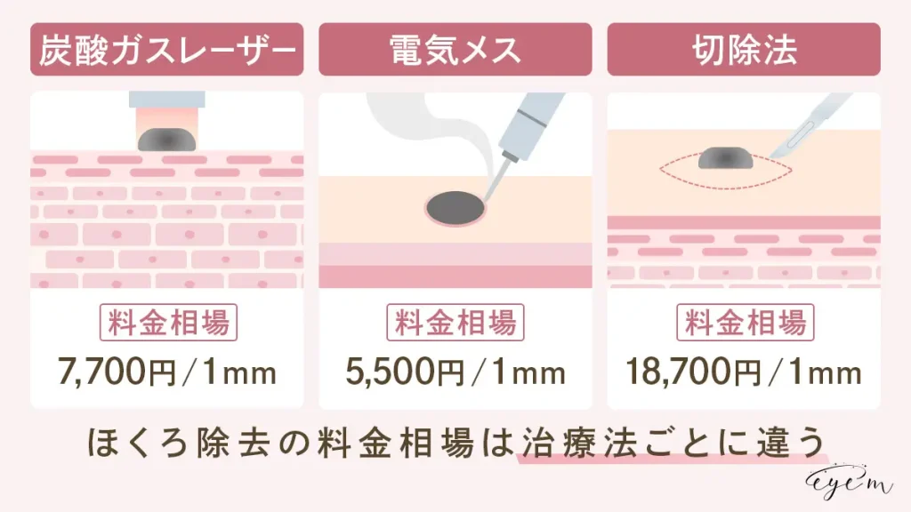 炭酸ガスレーザー 料金相場 7,700円／1mm 電気メス 料金相場 5,500円／1mm 切除法 料金相場 18,700円／1mm ほくろ除去の料金相場は治療法ごとに違う