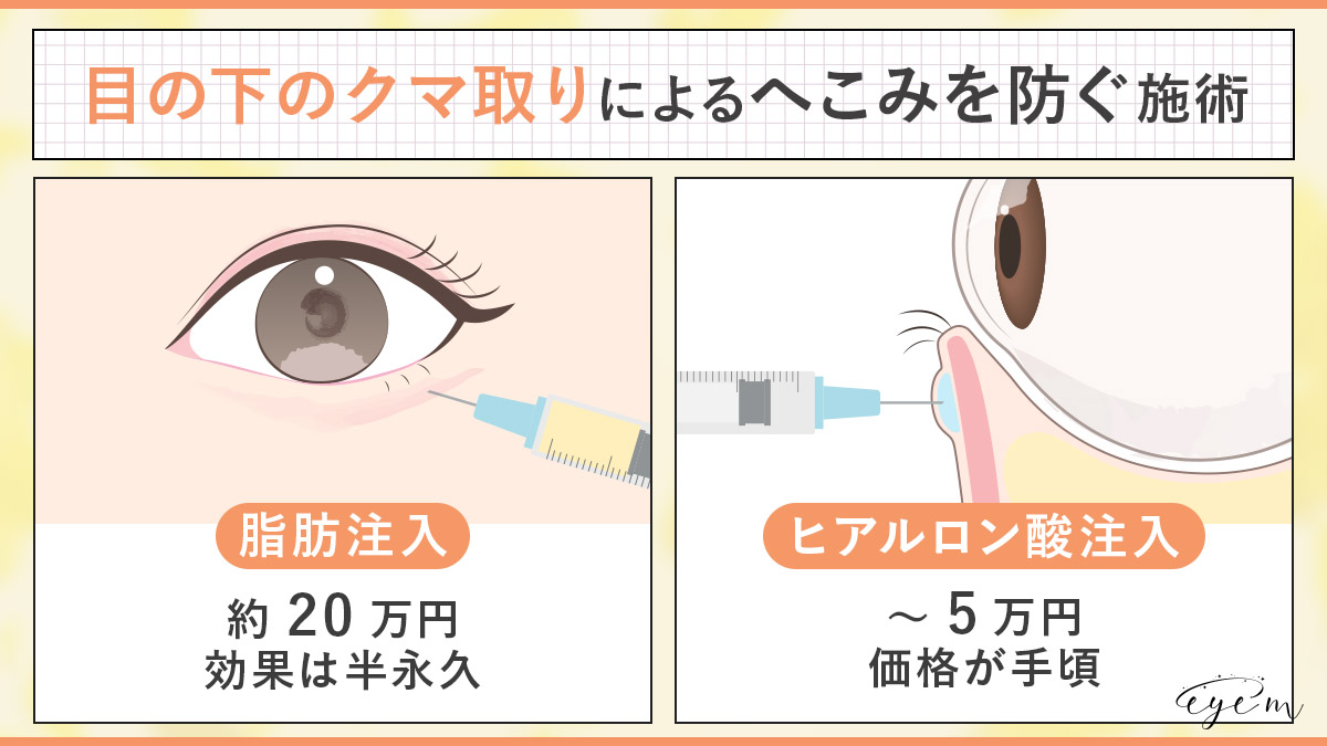 目の下のクマ取りによるへこみを防ぐ脂肪注入とヒアルロン酸注射の施術方法比較