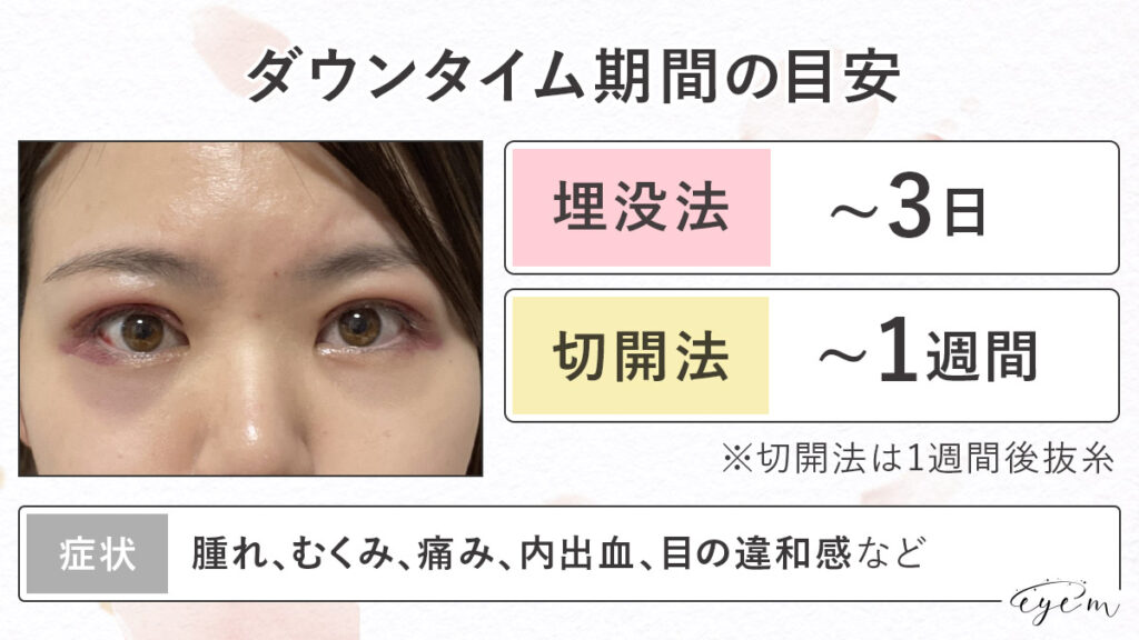 二重整形のダウンタイムは埋没法で3日、切開法で1週間前後