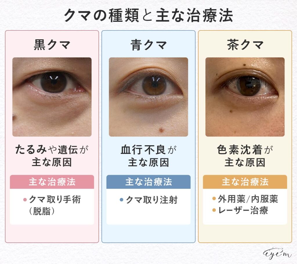 クマの種類と主な治療法