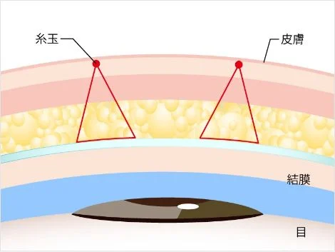 青春二重術