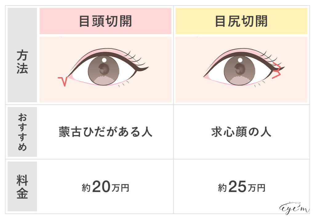 目頭切開と目尻切開の比較