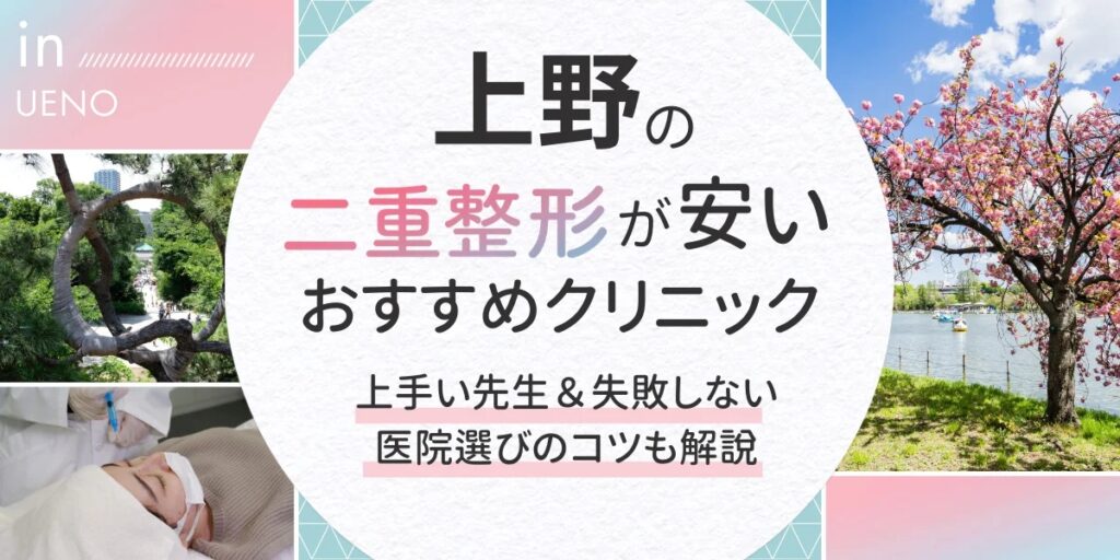 上野アイキャッチ