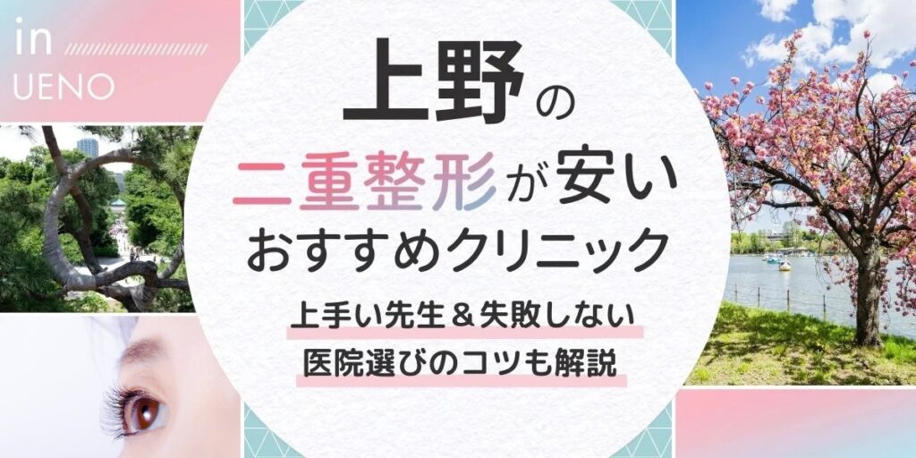 上野記事アイキャッチ