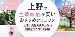 上野記事アイキャッチ